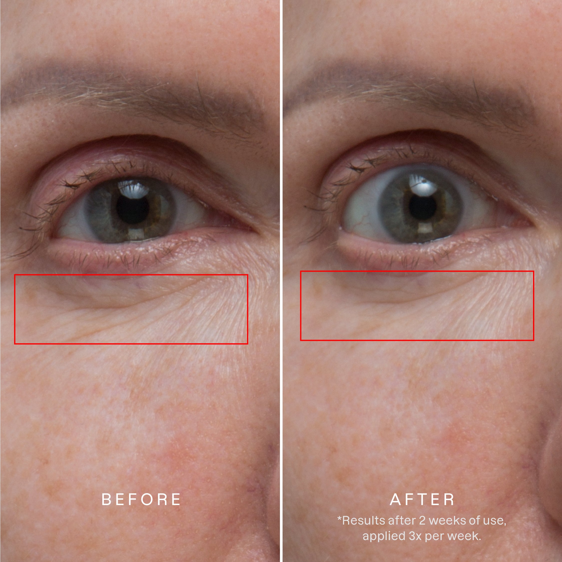 l-carnitine vs vitamin c for under eye skin BeautyStat Lactic acid is combined with three forms of vitamin C to increase absoption and enhance antioxidant performance for eye Understanding Age-Defying Actives: Vitamin C